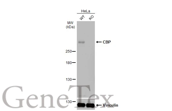 Wild-type (WT) and CBP knockout (KO) HeLa cell extracts (30 microg) were separated by 5% SDS-PAGE, and the membrane was blotted with CBP antibody (GTX56255) diluted at 1:500. The HRP-conjugated anti-rabbit IgG antibody (GTX213110-01) was used to detect the primary antibody.