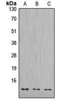 WB analysis of colchicine-treated HepG2 (A), mouse heart (B), rat heart (C) whole cell lysates using GTX56271 Cathepsin D Light chain antibody. WB analysis of colchicine-treated HepG2 (A), mouse heart (B), rat heart (C) whole cell lysates using GTX56271 Cathepsin D Light chain antibody.