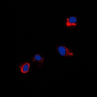 ICC/IF analysis of formalin-fixed NIH3T3 cells using GTX56276 Coxsackie Adenovirus Receptor antibody. Red : Primary antibody Blue : DAPI Permeabilization : 0.1% Triton X-100 in TBS for 5-10 minutes ICC/IF analysis of formalin-fixed NIH3T3 cells using GTX56276 Coxsackie Adenovirus Receptor antibody. Red : Primary antibody Blue : DAPI Permeabilization : 0.1% Triton X-100 in TBS for 5-10 minutes