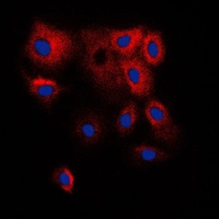 ICC/IF analysis of formalin-fixed HepG2 cells using GTX56284 CYP2B6 antibody. Red : Primary antibody Blue : DAPI Permeabilization : 0.1% Triton X-100 in TBS for 5-10 minutes ICC/IF analysis of formalin-fixed HepG2 cells using GTX56284 CYP2B6 antibody. Red : Primary antibody Blue : DAPI Permeabilization : 0.1% Triton X-100 in TBS for 5-10 minutes