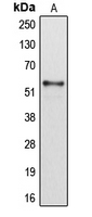 WB analysis of HepG2 (A) whole cell lysates using GTX56284 CYP2B6 antibody.