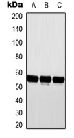 WB analysis of MCF7 (A), NIH3T3 (B), H9C2 (C) whole cell lysates using GTX56287 Cytochrome P450 2D6 antibody. WB analysis of MCF7 (A), NIH3T3 (B), H9C2 (C) whole cell lysates using GTX56287 Cytochrome P450 2D6 antibody.