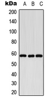 WB analysis of K562 (A), SP2/0 (B), PC12 (C) whole cell lysates using GTX56292 CYP8B1 antibody. WB analysis of K562 (A), SP2/0 (B), PC12 (C) whole cell lysates using GTX56292 CYP8B1 antibody.