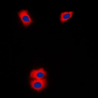 ICC/IF analysis of formalin-fixed Jurkat cells using GTX56293 CYP11A1 antibody. Red : Primary antibody Blue : DAPI Permeabilization : 0.1% Triton X-100 in TBS for 5-10 minutes ICC/IF analysis of formalin-fixed Jurkat cells using GTX56293 CYP11A1 antibody. Red : Primary antibody Blue : DAPI Permeabilization : 0.1% Triton X-100 in TBS for 5-10 minutes