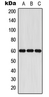 WB analysis of Jurkat (A), mouse liver (B), rat liver (C) whole cell lysates using GTX56293 CYP11A1 antibody.