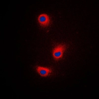 ICC/IF analysis of formalin-fixed A375 cells using GTX56299 TRP2 antibody. Red : Primary antibody Blue : DAPI Permeabilization : 0.1% Triton X-100 in TBS for 5-10 minutes ICC/IF analysis of formalin-fixed A375 cells using GTX56299 TRP2 antibody. Red : Primary antibody Blue : DAPI Permeabilization : 0.1% Triton X-100 in TBS for 5-10 minutes
