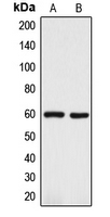 WB analysis of A375 (A), Y79 (B) whole cell lysates using GTX56299 TRP2 antibody.