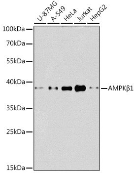 WB analysis of various sample lysates using GTX57162 AMPK beta 1 antibody. Dilution : 1:1000 Loading : 25microg per lane