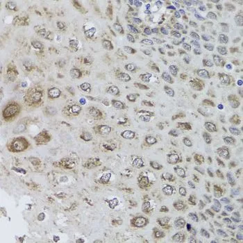 IHC-P analysis of human esophagus tissue using GTX57162 AMPK beta 1 antibody. Dilution : 1:100