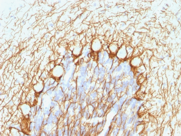 IHC-P analysis of human cerebellum tissue using GTX57165 NF-H (phospho) antibody [NE14].