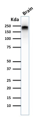 WB analysis of human brain tissue lysate using GTX57165 NF-H (phospho) antibody [NE14].