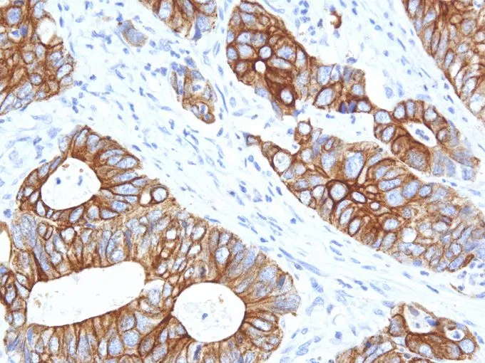 IHC-P analysis of human colon tissue using GTX57171 Cytokeratin 14 antibody [IHC555] (40X)