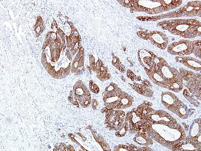 IHC-P analysis of human colon tissue using GTX57171 Cytokeratin 14 antibody [IHC555] (10X)