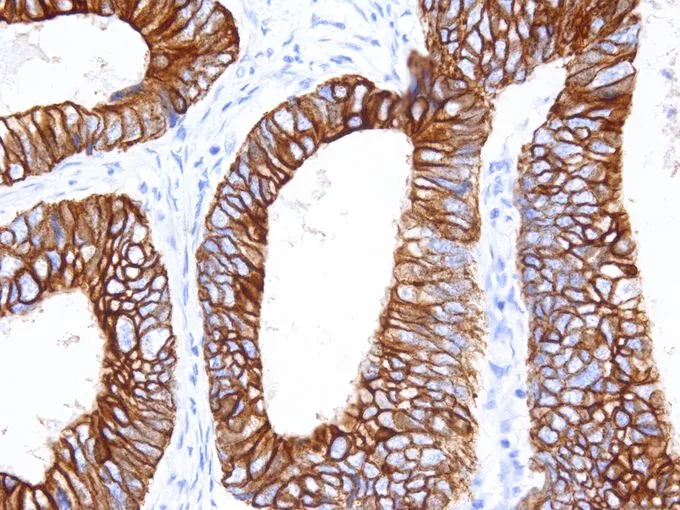 IHC-P analysis of human colon tissue using GTX57172 Cytokeratin 18 antibody [IHC018] (40X)