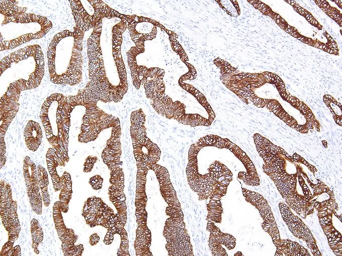 IHC-P analysis of human colon tissue using GTX57172 Cytokeratin 18 antibody [IHC018] (10X)