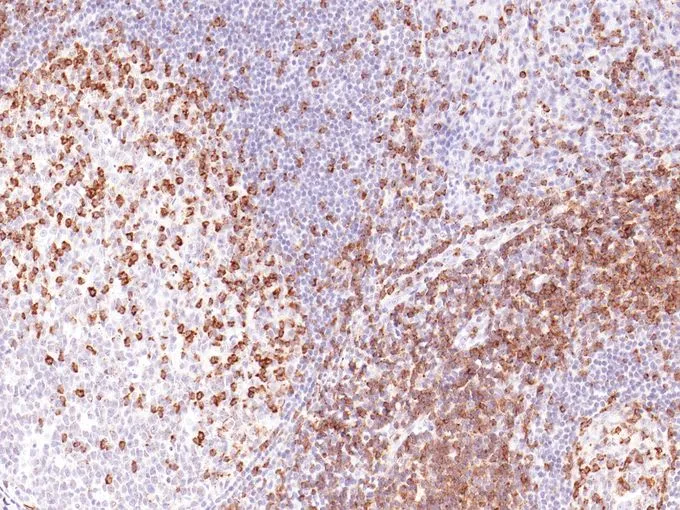 IHC-P analysis of human tonsil tissue using GTX57180 CD2 antibody [IHC531]