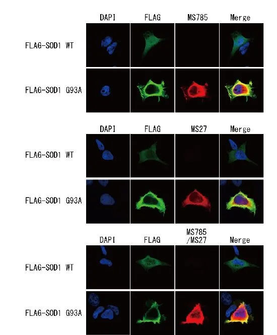 ICC/IF analysis of Flag-tagged SOD1 wild type or G93A mutant-expressing HEK293 cells using GTX57211 SOD1 (mutant) antibody [MS785], GTX57212 SOD1 (mutant) antibody [MS27] or MS785/MS27 cocktail. Fixation : 4% PFA for 10 min at RT. Permeabilization : 0.2% Triton X-100 for 5 min Dilution : 1microg/ml (12 hours at 4oC)