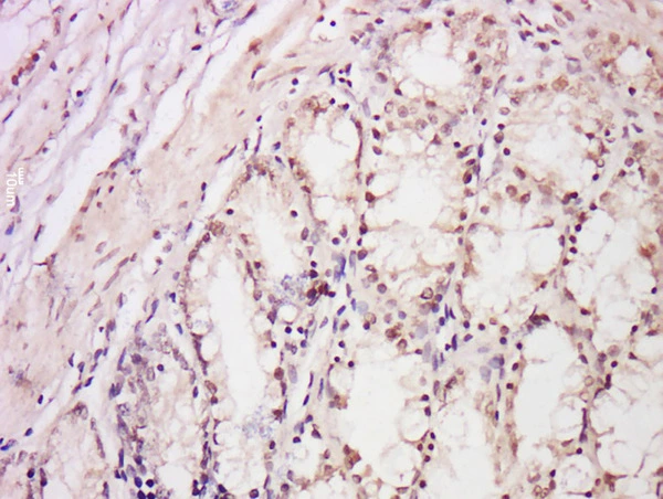 IHC-P analysis of rat intestine tissue using GTX57218 DDB2 antibody. Dilution : 1:300