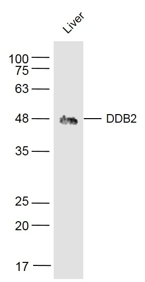 WB analysis of mouse liver tissue lysate using GTX57218 DDB2 antibody. Dilution : 1:500