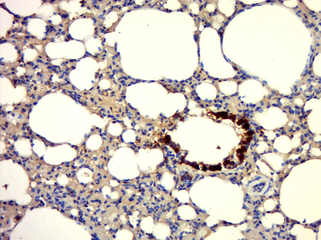 IHC-P analysis of rat lung tissue using GTX57228 Uteroglobin antibody. Antigen retrieval : Boiling in sodium citrate buffer (pH6.0) for 15 mins. Dilution : 1:400 IHC-P analysis of rat lung tissue using GTX57228 Uteroglobin antibody. Antigen retrieval : Boiling in sodium citrate buffer (pH6.0) for 15 mins. Dilution : 1:400