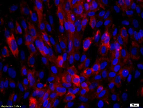 ICC/IF analysis of human endothelial cells using GTX57229 Uteroglobin antibody. Dilution : 1:50 Fixation: 4% PFA ICC/IF analysis of human endothelial cells using GTX57229 Uteroglobin antibody. Dilution : 1:50 Fixation: 4% PFA