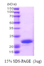 3?g Human CPI-17 protein (GTX57283-pro) by SDS-PAGE under reducing condition and visualized by coomassie blue stain.