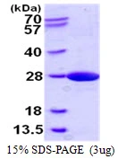 3?g Human NCE2 protein (GTX57349-pro) by SDS-PAGE under reducing condition and visualized by coomassie blue stain.