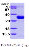 3?g Human NANP protein (GTX57351-pro) by SDS-PAGE under reducing condition and visualized by coomassie blue stain.