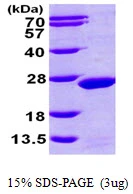 3?g Human MDP1 protein (GTX57357-pro) by SDS-PAGE under reducing condition and visualized by coomassie blue stain.