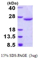 3?g Human DUSP18 protein (GTX57363-pro) by SDS-PAGE under reducing condition and visualized by coomassie blue stain.