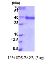 3?g Human HDGFL1 protein (GTX57368-pro) by SDS-PAGE under reducing condition and visualized by coomassie blue stain.