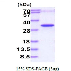 3?g Human PHOSPHO1 protein (GTX57373-pro) by SDS-PAGE under reducing condition and visualized by coomassie blue stain.