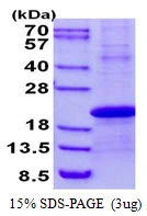 3microg Human Stella protein (GTX57416-pro) by SDS-PAGE under reducing condition and visualized by coomassie blue stain. 3microg Human Stella protein (GTX57416-pro) by SDS-PAGE under reducing condition and visualized by coomassie blue stain.