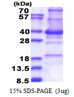 3?g Human CENPP protein (GTX57430-pro) by SDS-PAGE under reducing condition and visualized by coomassie blue stain.