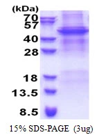 3µg Human APOBEC4 protein (GTX57432-pro) by SDS-PAGE under reducing condition and visualized by coomassie blue stain.