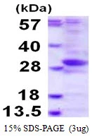 3?g Human Phosphatase orphan 2 protein (GTX57440-pro) by SDS-PAGE under reducing condition and visualized by coomassie blue stain.