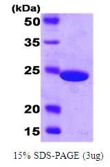 3?g Carbonic Anhydrase protein (GTX57462-pro) by SDS-PAGE under reducing condition and visualized by coomassie blue stain.