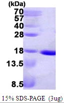 3?g ndk protein (GTX57465-pro) by SDS-PAGE under reducing condition and visualized by coomassie blue stain.