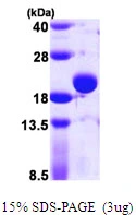 3?g TPX protein (GTX57467-pro) by SDS-PAGE under reducing condition and visualized by coomassie blue stain.