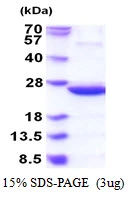 3?g idnk protein (GTX57468-pro) by SDS-PAGE under reducing condition and visualized by coomassie blue stain.
