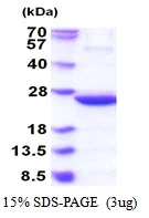 3microg idnk protein (GTX57468-pro) by SDS-PAGE under reducing condition and visualized by coomassie blue stain.