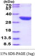3?g glsA1 protein (GTX57470-pro) by SDS-PAGE under reducing condition and visualized by coomassie blue stain.