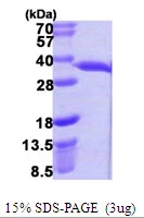 3?g hchA protein (GTX57473-pro) by SDS-PAGE under reducing condition and visualized by coomassie blue stain.