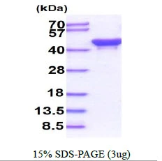 3?g ackA protein (GTX57475-pro) by SDS-PAGE under reducing condition and visualized by coomassie blue stain.