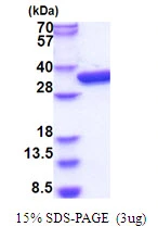 3?g glk protein (GTX57476-pro) by SDS-PAGE under reducing condition and visualized by coomassie blue stain.