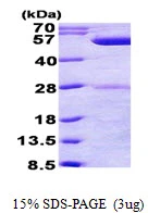 3?g phrB protein (GTX57479-pro) by SDS-PAGE under reducing condition and visualized by coomassie blue stain.