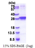 3?g ung protein (GTX57480-pro) by SDS-PAGE under reducing condition and visualized by coomassie blue stain.