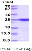 3?g nth protein (GTX57482-pro) by SDS-PAGE under reducing condition and visualized by coomassie blue stain.