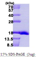 3?g msrB protein (GTX57483-pro) by SDS-PAGE under reducing condition and visualized by coomassie blue stain.