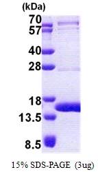 3microg Human TEN1 protein (GTX57506-pro) by SDS-PAGE under reducing condition and visualized by coomassie blue stain. 3microg Human TEN1 protein (GTX57506-pro) by SDS-PAGE under reducing condition and visualized by coomassie blue stain.